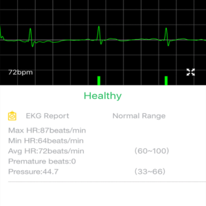Mobile ECG app - report