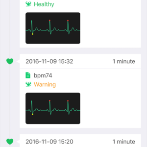 Mobile ECG app - history