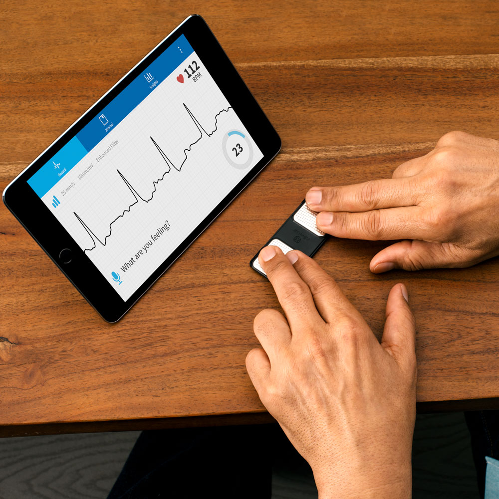 AliveCor KardiaMobile ECG Heart Monitor with App